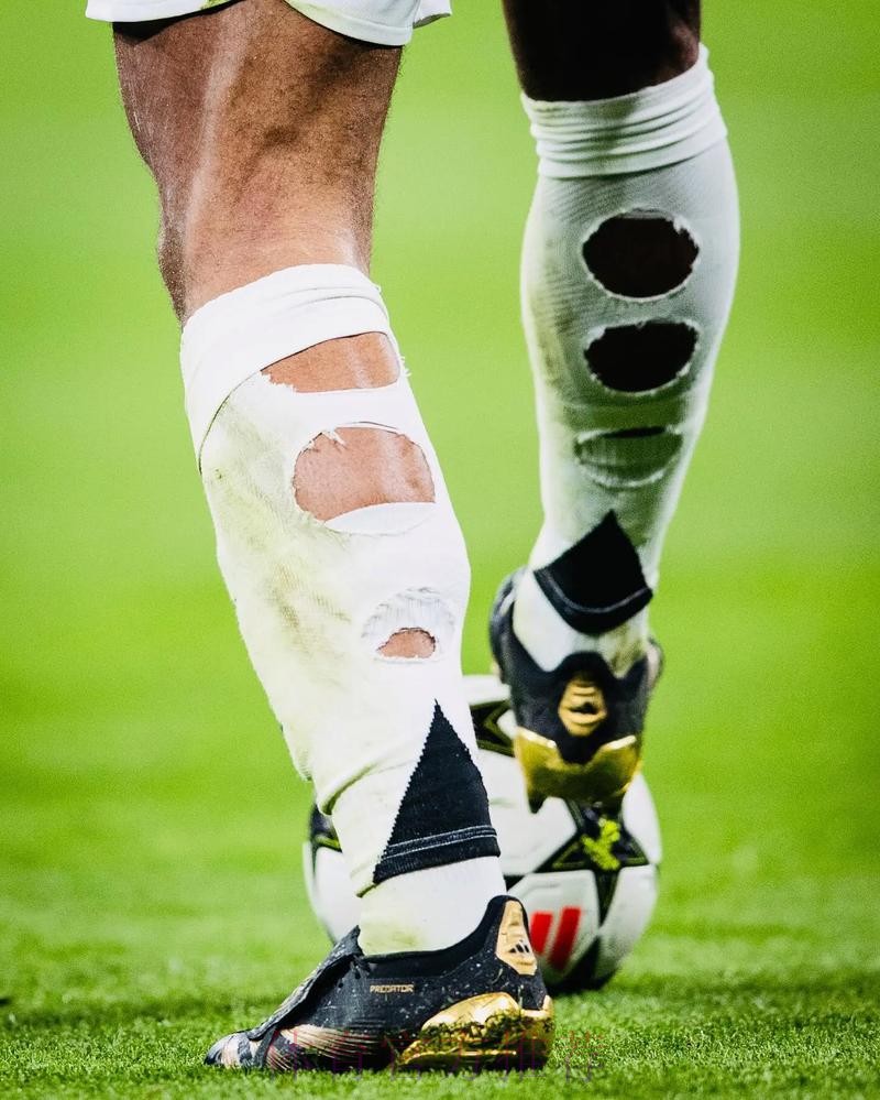 贝林穿破洞球袜属于违规 但因健康因素放宽限制 贝林穿破洞球袜属于违规 但因健康因素放宽限制