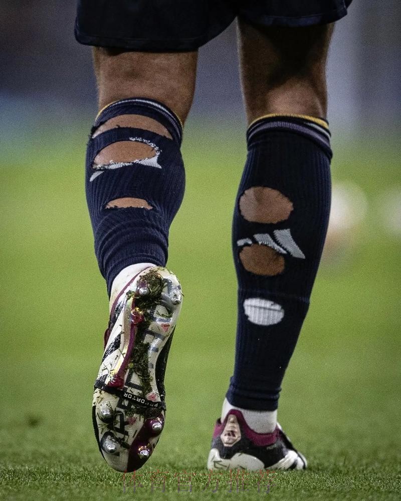 贝林穿破洞球袜属于违规 但因健康因素放宽限制 贝林穿破洞球袜属于违规 但因健康因素放宽限制